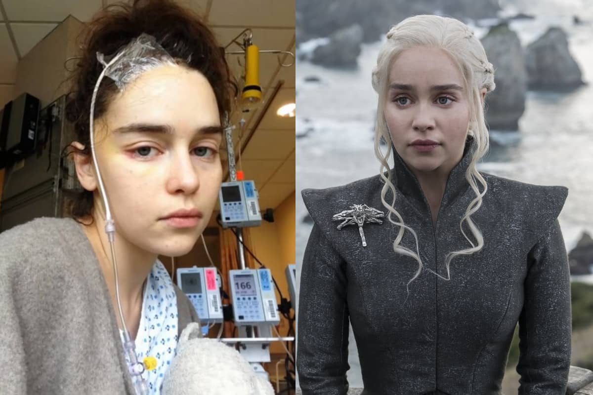 emilia-clarke-reveals-never-before-seen-photos-from-her-brain-surgery-3-3172085